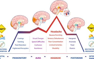 The 4 Migraine Phases: What is Your Body Trying to Tell You?
